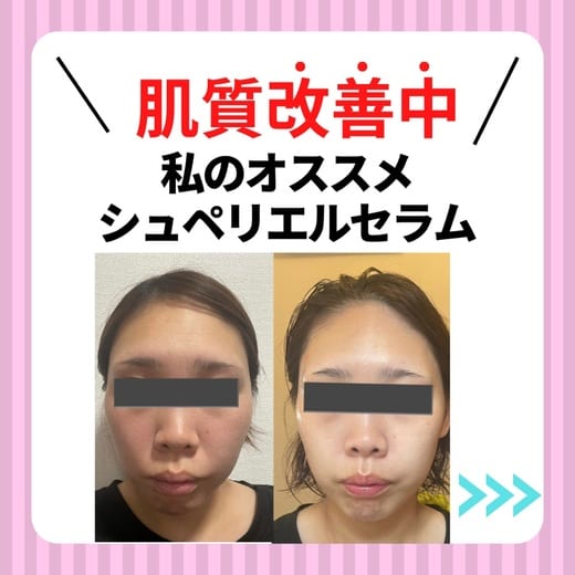 リピーター続出のオリジナル美容液「シュペリエルセラム」がお得に！大感謝キャンペーン開催決定✨
